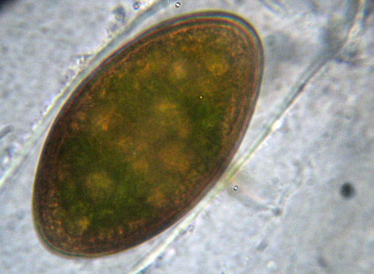 Alghe 3: Spirogyra sp